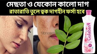 মেছতা ও ত্বকের কালো দাগ তুলে দেবে রাতারাতি/ত্বক হবে দুধের মত ফর্সা উজ্জ্বল/Remove pigments