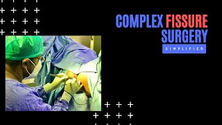 Complex Fissure Surgery Simplified