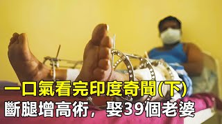 一口氣看完印度駭人奇聞，為了長高10厘米，寧願花10萬把腿打斷再接骨