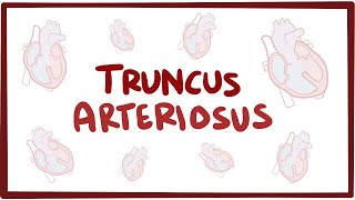 Truncus arteriosus (TA) - causes, symptoms, diagnosis, treatment & pathology