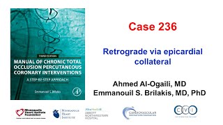 Case 236: Manual of CTO PCI - Retrograde via epicardial collateral