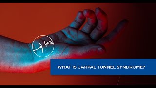 What is Carpal Tunnel Syndrome? | What are the symptoms of Carpal Tunnel Syndrome? |Apollo Hospitals