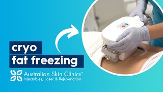 CryoDefine Fat Freezing | Australian Skin Clinics