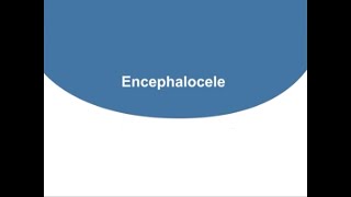 Encephalocele