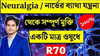 স্নায়ুর ব্যাথা | নার্ভের ব্যথা দুর করার সহজ উপায় | homeopathic medicine for Neuralgia r 70 |