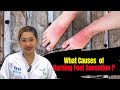 What Causes Burning Sensation in Feet | Burning Feet | Remedy | 100% Effective | 2022