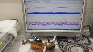 基礎実験ーー低周波刺激で高周波を制御する超音波技術ーー（超音波システム研究所）