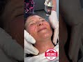 massage-peeling-de-luxe-plus-HD