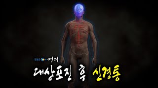 [명의 의학백과📖] 대상포진 후 신경통