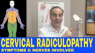 Cervical Radiculopathy Symptoms, Nerve Chart, Nerve Distribution | Dr. Walter Salubro