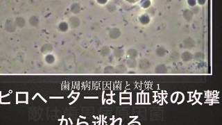 京都市伏見区、宇治市でお馴染みの仁科歯科医院、歯周病原因菌と対策と定期健診