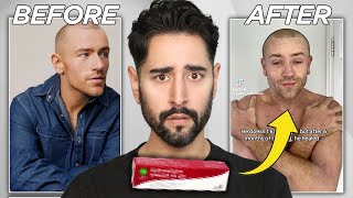 The Skin Condition That Doesn’t Exist... But Everyone Could Suffer From - When Beauty Turns Ugly