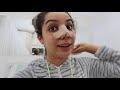 tirei os pontos vlog rinoplastia 2