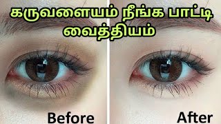 கருவளையம் நீங்க பாட்டி வைத்தியம்|karuvalayam neenga|How to remove dark circles in tamil