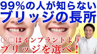 【歯のブリッジ】インプラントが正解とは限らない！