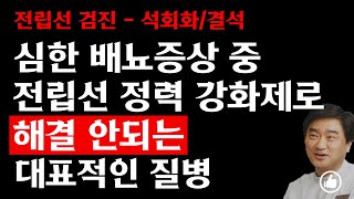 심한 배뇨증상 중에 전립선 정력 강화제로 해결 안되는 대표적인 질병