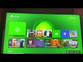 Xbox Series X/S: How to Fix Error “0x803F81F5” Occurs When Installing Game or App Tutorial! (2021)