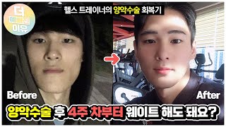 [2편] 양악수술 후 4주 차부터 웨이트 해도 되나요? 헬스 트레이너의 남자 양악수술 이야기