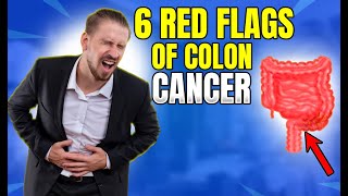6 Warning Signs of Colon Cancer You Should NEVER Ignore