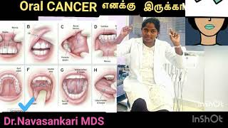 Oral CANCER எனக்கு இருக்கா?How to diagnose it??8 Steps #videos#cancer#cancerdiagnoseintamil#lifesave