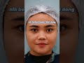 FILLER HIDUNG #youtubeshorts #shortsvideo #youtube #kecantikanwajah #fypシ #fyp