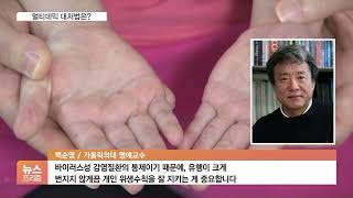 독감에 수족구병까지 확산…'멀티데믹' 대처법은?