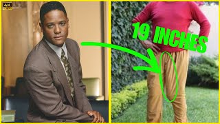 15 Celebrities...With Weird Body Deformities | Hollywood Discovery