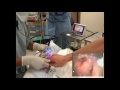 glidescope pediatric airway rounds case study 2 month old inguinal hernia repair