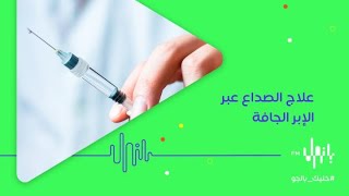 علاج الصداع عبر الإبر الجافة