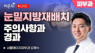 [김형수의 더마talk] '눈밑지방재배치의 주의사항과 경과' / 서울에이치피부과 김형수