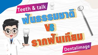 ฟันธรรมชาติ VS รากฟันเทียม | #รากฟันเทียม เคี้ยวได้เหมือน #ฟันธรรมชาติ ไหม?