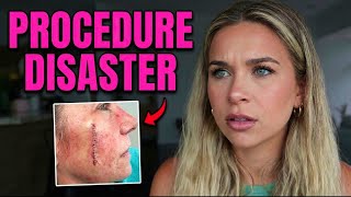 procedures i've had done and the disaster that followed