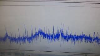 ６００ＭＨｚ以上の超音波伝搬状態を可能にする超音波発振制御プローブ