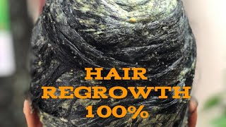 #hairpack #dandruff #damagedhair //HAIR REGROWTH PACK.. 100% నేను ఫలితాన్ని పొందాను