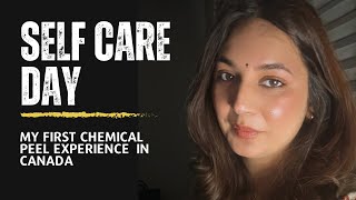 GETTING MY FIRST CHEMICAL PEEL FACIAL l LIFE IN CANADA VLOG 🇨🇦