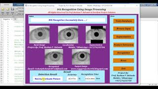 Matlab Code for Iris Recognition Using Image Processing Matlab Project Code || IEEE Based Projects