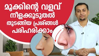 മൂക്കിന്റെ വളവ്, നീളക്കൂടുതൽ തുടങ്ങിയ പ്രശ്നങ്ങൾ പരിഹരിക്കാം | Rhinoplasty malayalam