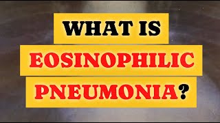 What is eosinophilic pneumonia?