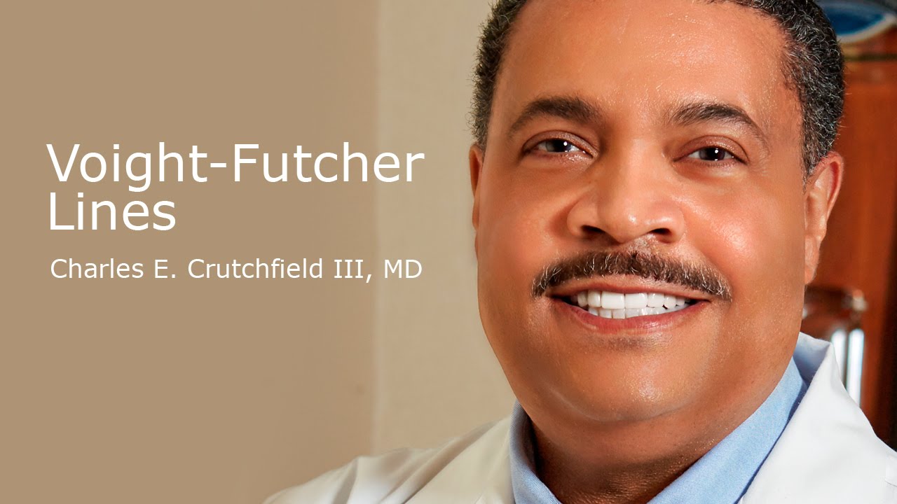 Voight Futcher Lines Youtube