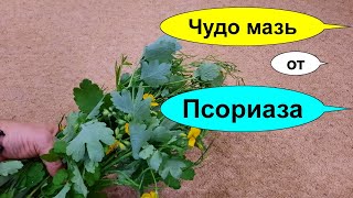 Чудо мазь от ПСОРИАЗА. Чесотка и зуд уходят прочь. Лечение псориаза ЧИСТОТЕЛОМ и СОЛИДОЛОМ