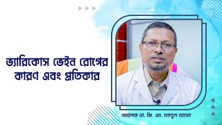 পায়ের আঁকা বাঁকা মোটা শিরা বা ভ্যারিকোস ভেইন : কারণ এবং প্রতিকার || অধ্যাপক ডা. জি. এম. মকবুল হোসেন