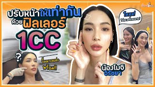 ปรับโครงหน้าให้เท่ากัน ด้วยฟิลเลอร์ 1 ซีซี กับน้องโม จิรัชยา by #พี่หมอออย