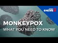 Monkeypox: What You Need to Know | Part 1