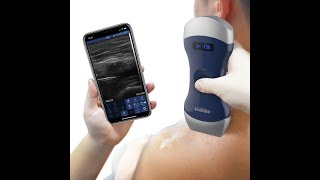 Viatom Double Head Ultrasound (Sonostar Urprobe C) - mobiles Ultraschallgerät