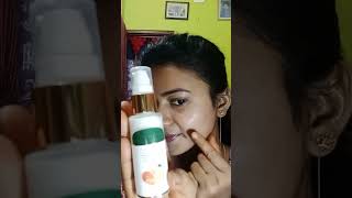 BIOTIQUE VITAMIN C Dark spot solution For All Skin Types ...#shorts #...❤❤❤🙏👍🥰