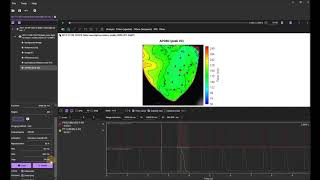 Data Analysis using BV Workbench - 4-2. Action potential duration (APD) map