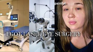 I GOT LASER EYE SURGERY | my experience getting Lasik