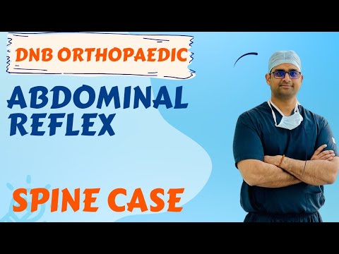 Abdominal Reflex(DNB/MS Practical Orthopaedics Examination) - YouTube