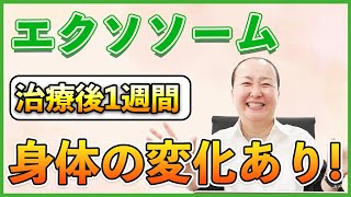 【体験談】エクソソーム治療をしてみた結果は?身体に影響がありました!【注射/口コミ/若返り/医療】