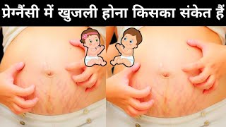 प्रेग्नैंसी में खुजली होना किसका संकेत हैं!pregnancy me khujli ho to kya kare